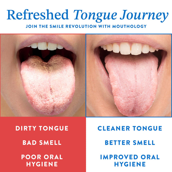 Mouthology Tongue Brushes and Tongue Scraper 2pk Dark Blue (WS)